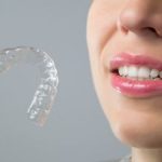 Invisalign Kennesaw GA