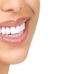 Patient Smiling After Porcelain Veneers from Kennesaw Mountain Dental Associates