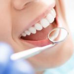 Dental Procedure Kennesaw GA